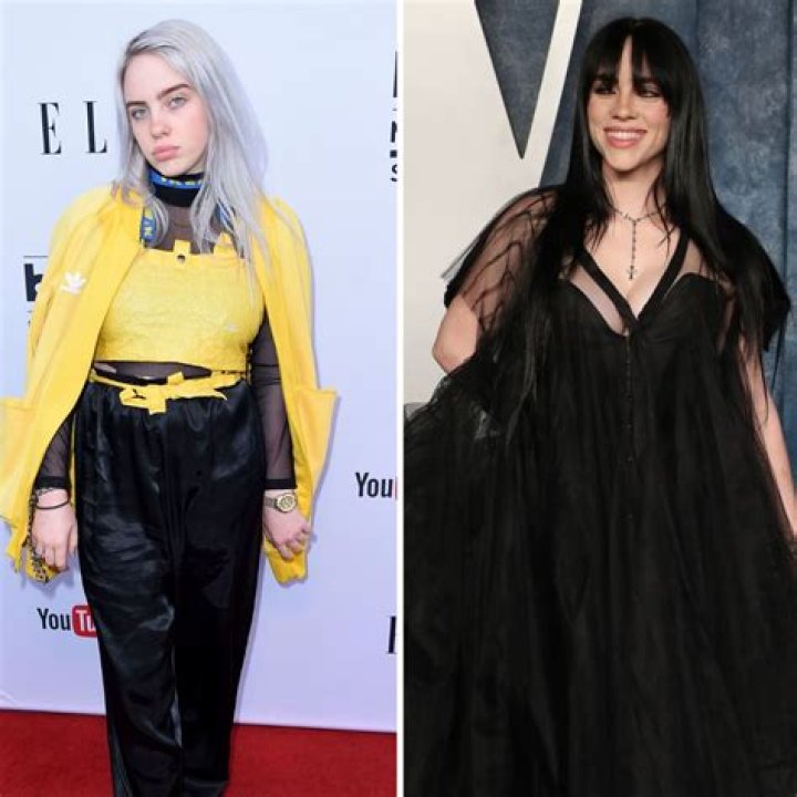 Billie Eilish Breast Reduction: A Journey to Body Positivity and Self-Acceptance